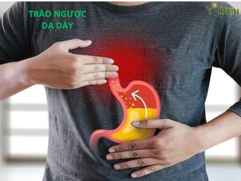 Khi trào ngược dạ dày sẽ thấy nhiều các triệu chứng gây ra như: nóng rát, ợ hơi ợ chua